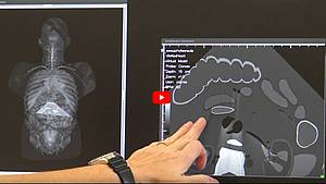 Screenshot Video Sonography