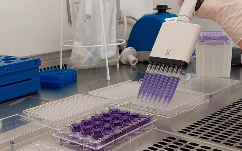 Hand beim pipettieren