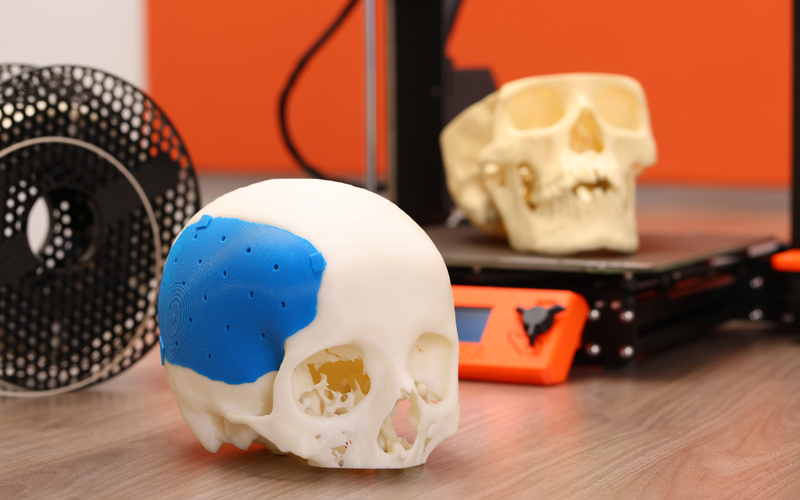 Schädel 3D gedruckt