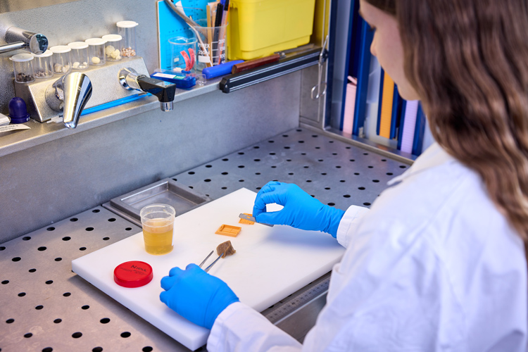 Eine Biomedizinische Analytikerin führt eine makroskopische Untersuchung und Präparation eines Gewebestückes durch. Mit einer Pinzette in der linken Hand wird die Gewebeprobe auf einem Schneidebrett fixiert, während mit der rechten Hand und einer Skalpellklinge präzise Schnitte an dem Gewebe vorgenommen werden.