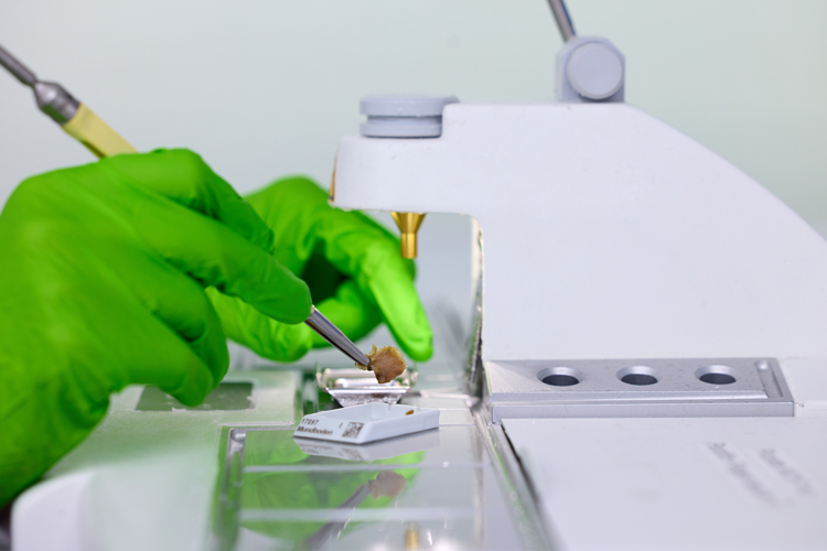 Im Bild sieht man eine*n Biomedizinische Analytiker*in, die*der an einer Ausgießstation arbeitet. Mit einer Pinzette hält die Person ein Gewebestück direkt unter den Spender für das Paraffinwachs, um es mit diesem zu füllen. Das Gewebestück wird mit flüssigem Paraffinwachs versetzt, um es nach dem Erhärten vollständig zu stabilisieren und einzubetten, sodass anschließend hauchdünne und gleichmäßige Schnitte für die mikroskopische Untersuchung am Mikrotom angefertigt werden können.