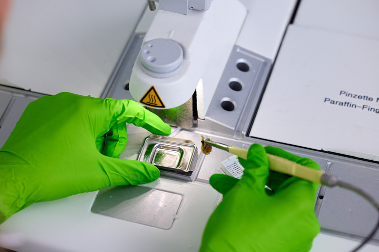 Im Bild ist die präzise Tätigkeit der histologischen Einbettung zu sehen. Das Gewebe wird vorsichtig in die Metallform gegeben, zeitgleich wird flüssiges Paraffin aus dem weißen Spender über dem Arbeitsbereich in die Metallform dosiert, um das Gewebe vollständig zu umschließen.
