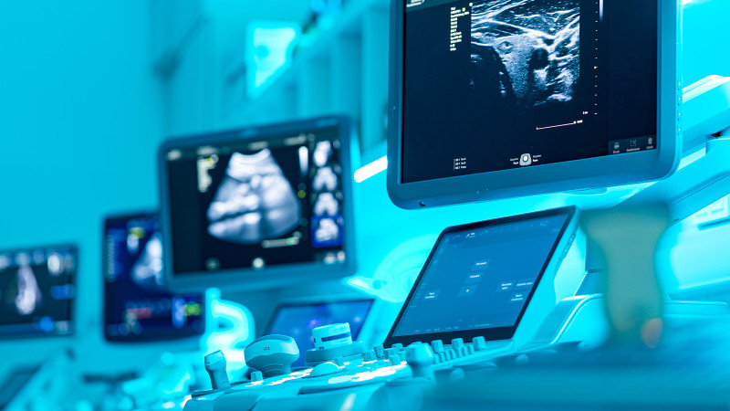 Monitore mit Ultraschallbildern in blau ausgeleuchtetem Raum